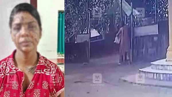 Crime News: ప్రేమ గుడ్డి వాడిని చేసింది.. పెళ్లి తిరస్కరించిన యువకుడిపై యాసిడ్ పోసిన వివాహిత!