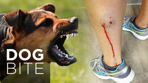 Dog Bite: కరిచింది కుక్కే కదా అని కారంపొడి పెట్టుకుని పడుకోవద్దు.. డాక్టర్ వద్దకు వెళ్ళకపోతే ఇంతే సంగతులు!