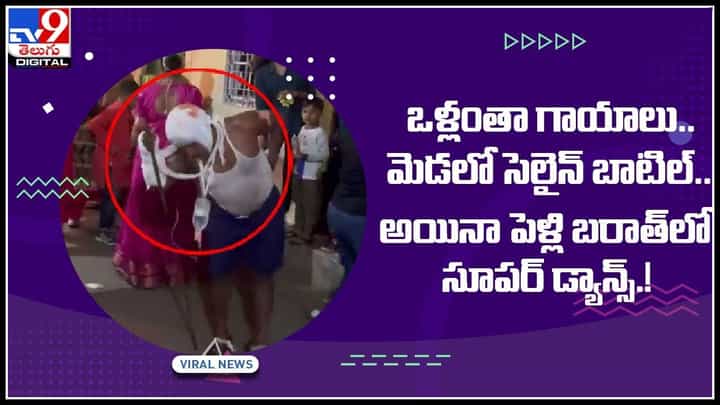 VIRAL DANCE: ఒళ్లంతా గాయాలు.. మెడలో సెలైన్ బాటిల్.. అయినా పెళ్లి బరాత్లో సూపర్ డ్యాన్స్.! వైరల్ అవుతున్న వీడియో.. VIRAL DANCE: ఒళ్లంతా గాయాలు.. మెడలో సెలైన్ బాటిల్.. అయినా పెళ్లి బరాత్లో సూపర్ డ్యాన్స్.! వైరల్ అవుతున్న వీడియో..