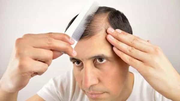 Hair Care Tips: బట్టతల వస్తుందని భయపడుతున్నారా..? ఇలా చేస్తే వృద్ధాప్యం వరకు జుట్టు రాలదు..