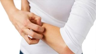 Baking Soda vs Baking Powder: చూడ్డానికి ఒకేలా ఉన్నా.. వీటి మధ్య చాలే తేడా ఉంటుంది.. అవేంటో తెలుసా..