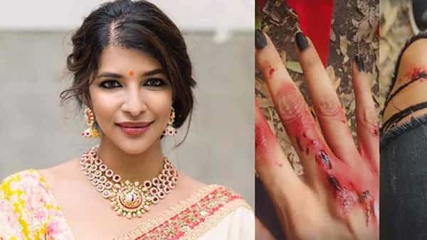 Lakshmi Manchu: నెట్టింట వైరల్ అవుతున్న యాక్సిడెంట్ పిక్స్.. క్లారిటీ ఇచ్చిన మంచు లక్ష్మి.. అసలేమైందంటే..?