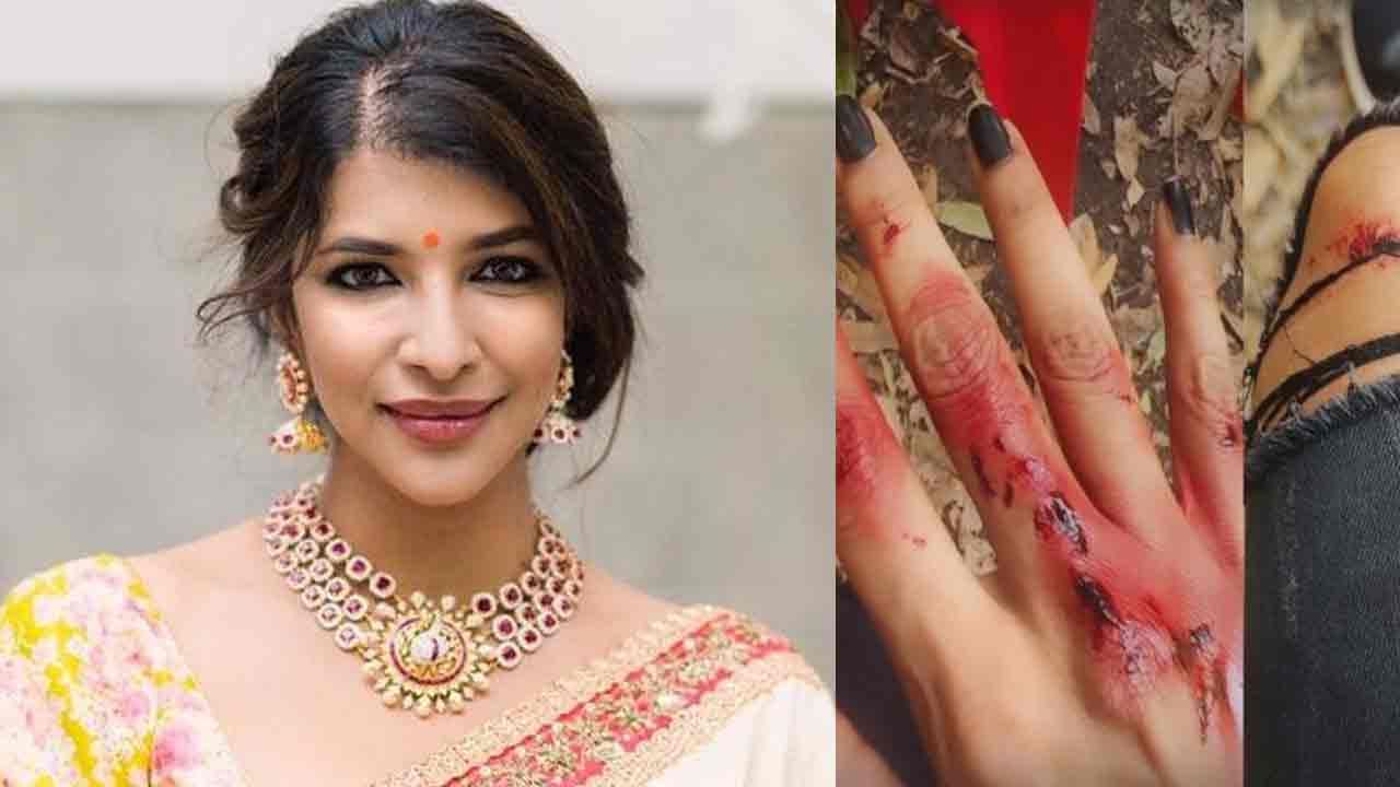 Lakshmi Manchu: నెట్టింట వైరల్ అవుతున్న యాక్సిడెంట్ పిక్స్‌.. క్లారిటీ ఇచ్చిన మంచు లక్ష్మి.. అసలేమైందంటే..?