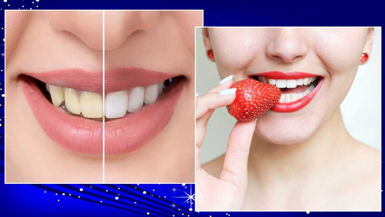 Teeth Tips: ప‌చ్చ‌గా ఉన్న‌ ప‌ళ్ల‌ను తెల్ల‌గా మార్చే స‌ర్‌ప్రైజింగ్ కిచెన్ రెమిడీస్..