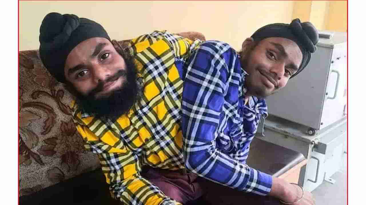 Conjoined Twins: వారు ఇద్దరు కాదు ఒక్కరు.. పంజాబ్ కుర్రాళ్లు ఉద్యోగం సాధించారు.. స్ఫూర్తిగా నిలిచారు..