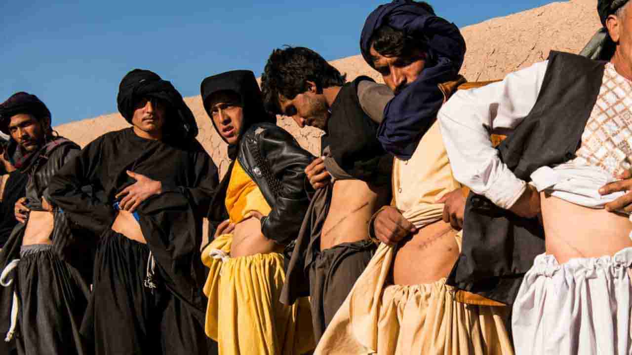 Afghanistan Taliban: తాలిబన్ల రాజ్యంలో ఆకలి కేకలు.. అవయవాలు అమ్ముకుంటున్న ఆఫ్గాన్లు..