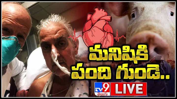 Pig Heart Into Human Body: వైద్యశాస్త్రంలో మరో మిరాకిల్.. మనిషికి పంది గుండె అమరిక సక్సెస్..(లైవ్ వీడియో) Pig Heart Into Human Body: వైద్యశాస్త్రంలో మరో మిరాకిల్.. మనిషికి పంది గుండె అమరిక సక్సెస్..(లైవ్ వీడియో)