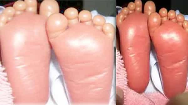 Viral: సంచలనం.. ‘ప్లాస్టిక్ బిడ్డ’కి జన్మనిచ్చిన మహిళ.. ఇండియాలోనే