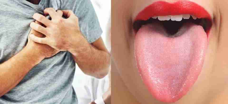 Tongue Color: గుండెపోటును మన నాలుక రంగుతో తెలుసుకోవచ్చు.. ఎలా గుర్తించాలంటే..?