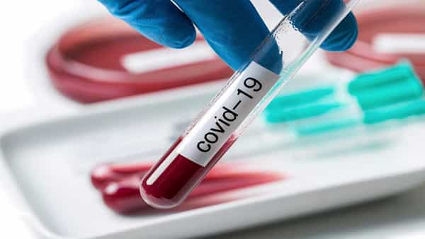 India Corona: దేశవ్యాప్తంగా తగ్గుముఖం పడుతున్న కరోనా.. కొత్తగా 50,407 మందికి పాజిటివ్, 804మంది మృతి