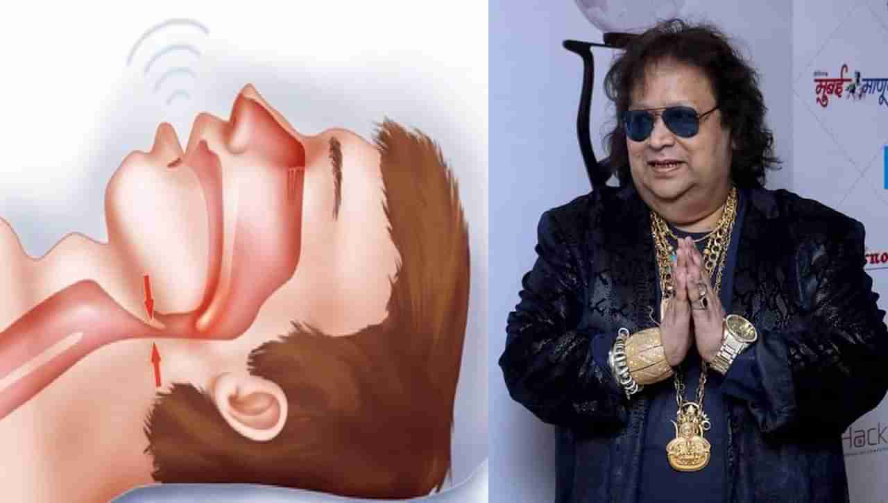 Bappi Lahiri: బప్పి లహిరి మృతికి కారణమైన అబ్‌స్ట్రక్టివ్ స్లీప్ అప్నియా అంటే ఏంటి.? ఎలా గుర్తించాలి.? లక్షణాలు ఏంటి.?