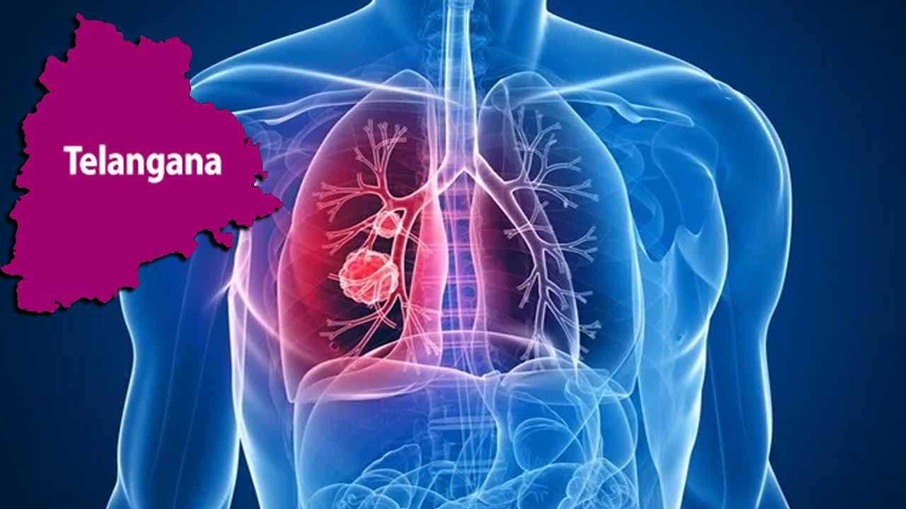 Telangana Cancer: తెలంగాణలో పెరుగుతున్న క్యాన్సర్‌ కేసులు.. మూడేళ్లలో ...