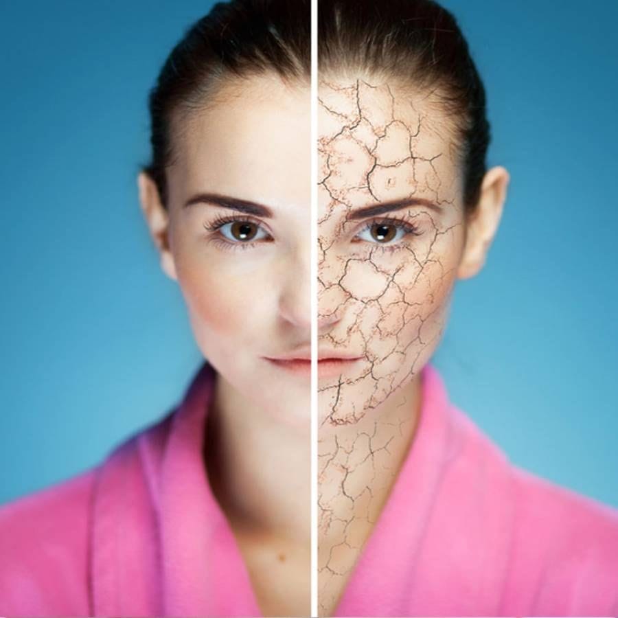 పొడి చర్మం: వేసవిలో పొడి చర్మం సమస్య తరచుగా ఇబ్బంది పెడుతుంది. ఈ సమస్యను అధిగమించడానికి ఒక గిన్నెలో తురిమిన యాపిల్ తీసుకుని అందులో ఒక చెంచా గ్లిజరిన్ - రోజ్ వాటర్ వేసి కలపాలి. ఈ పేస్ట్‌ను ముఖానికి అప్లై చేసిన తర్వాత కొంతసేపు ఉంచి నీటితో శుభ్రంచేసుకోవాలి.