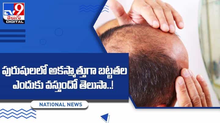 పురుషులలో అకస్మాత్తుగా బట్టతల ఎందుకు వస్తుందో తెలుసా ?? పురుషులలో అకస్మాత్తుగా బట్టతల ఎందుకు వస్తుందో తెలుసా ??