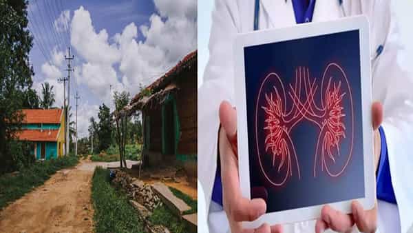 Andhra Pradesh: ఏపీలో మరో చోట కిడ్నీ వ్యాధి డేంజర్ బెల్స్.. చికిత్స కోసం ఆస్తులు అమ్ముకుంటున్నా..