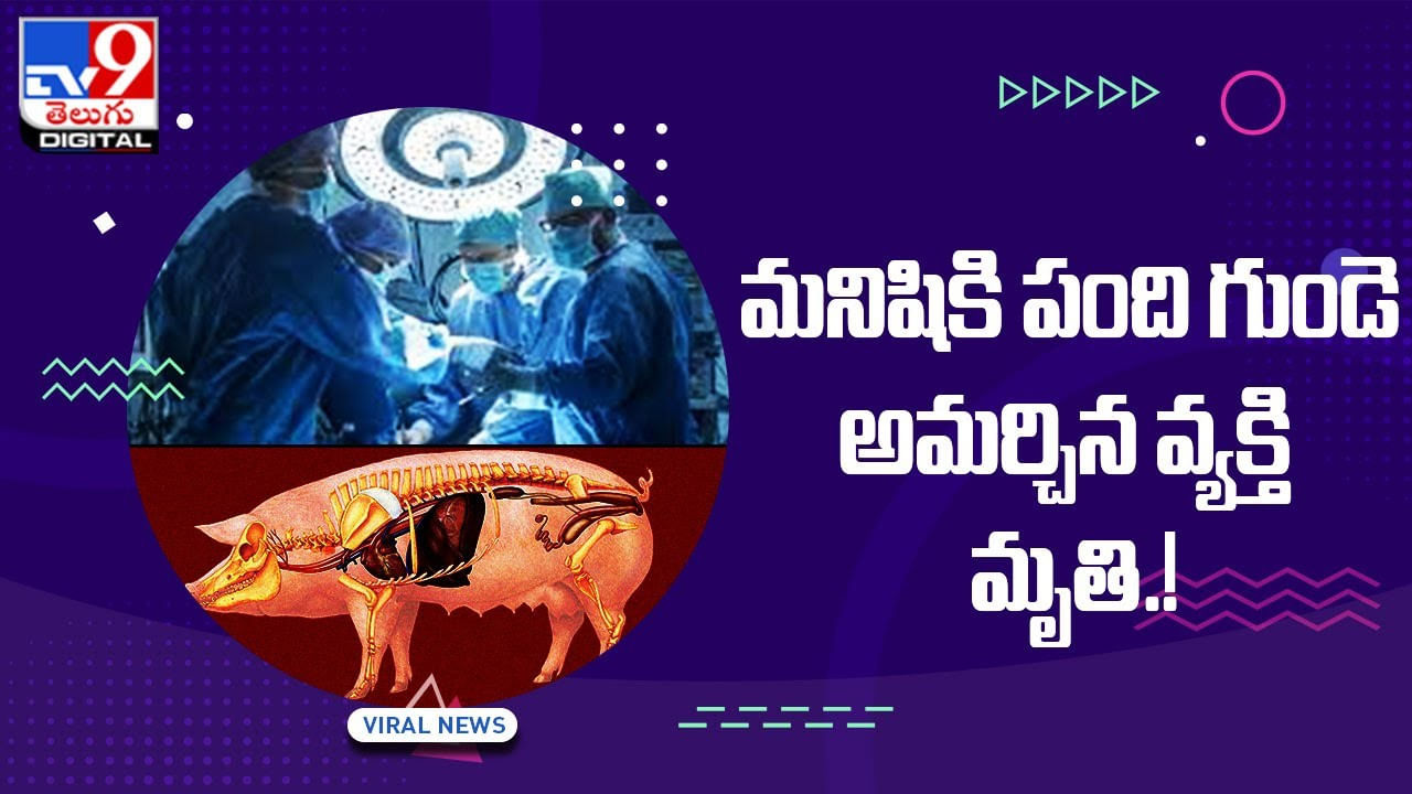 మనిషికి పంది గుండె అమర్చిన వ్యక్తి మృతి.!