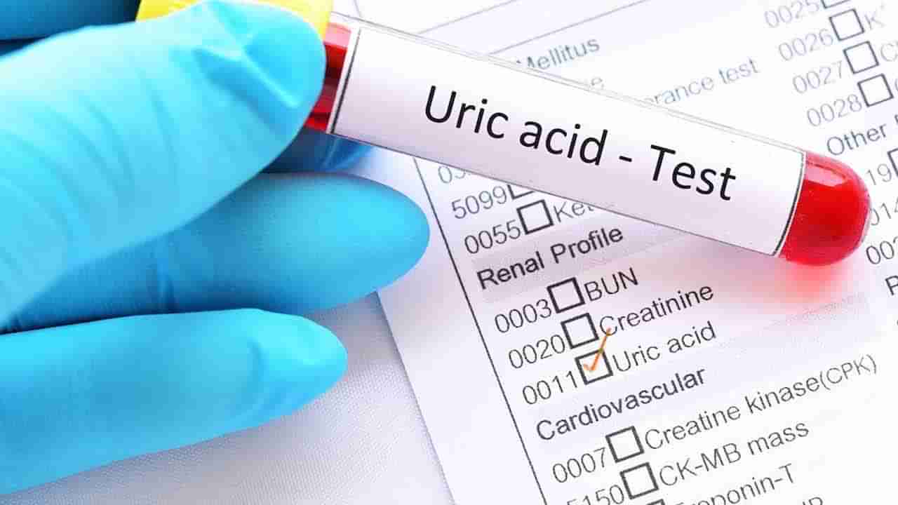 Uric Acid Issues: యూరిక్ యాసిడ్ సమస్యతో బాధపడేవారు వీటిని అస్సలు తీసుకోవద్దు.. లేదంటే ముప్పు తప్పదు..!