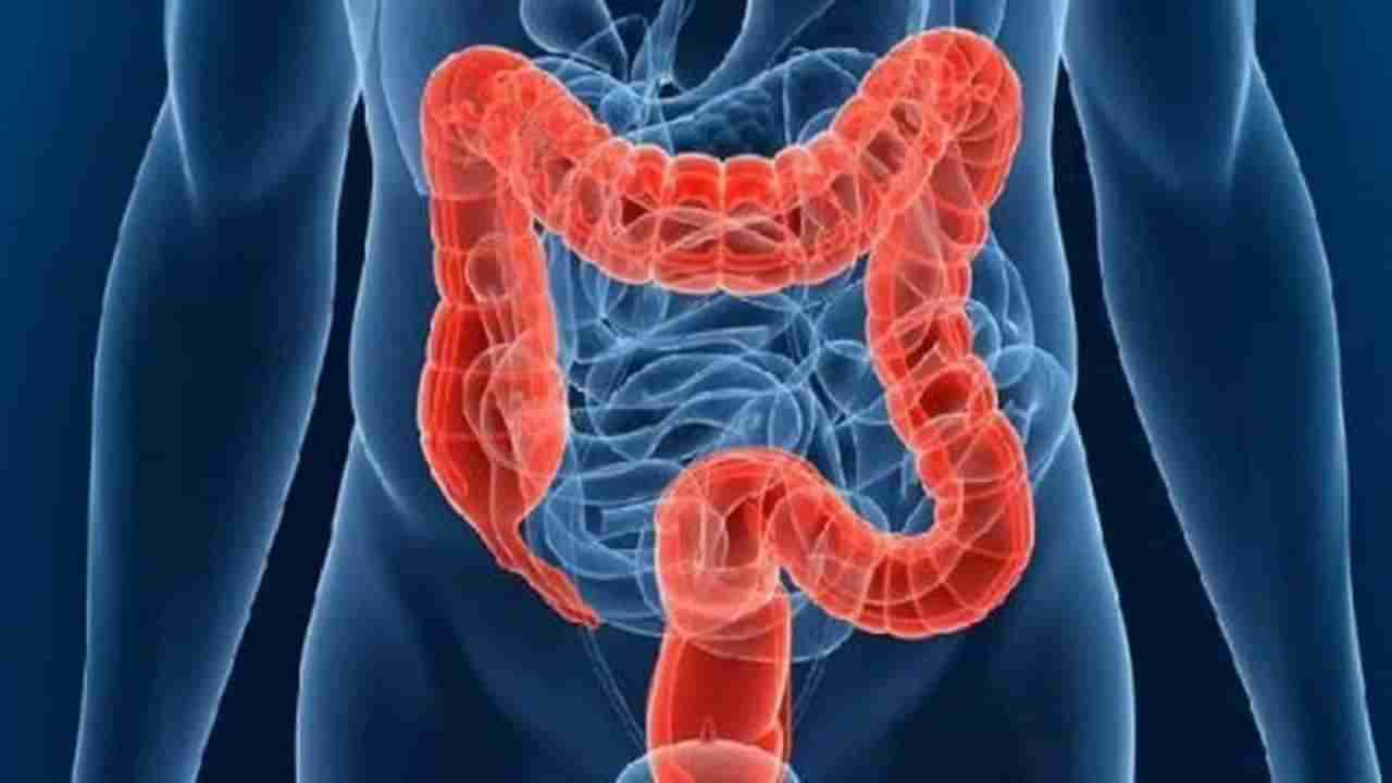 Stomach Gas Remedies: కొంచెం తిన్నా గ్యాస్ తన్నుకొస్తుందా..? ఈ సమస్యకు ఎలా చెక్ పెట్టాలో తెలుసుకోండి