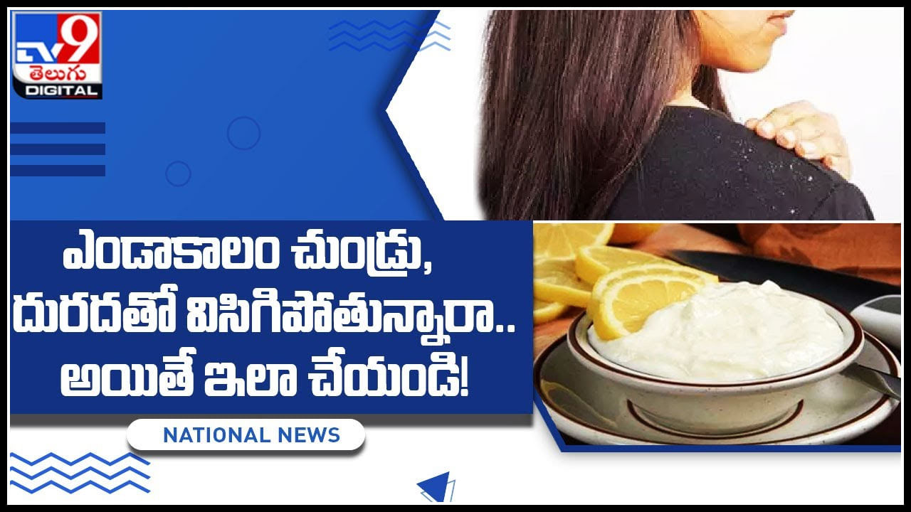 Beauty Tips for summer: ఎండాకాలం చుండ్రు, దురదతో విసిగిపోతున్నారా.. అయితే ఇలా చేయండి..!