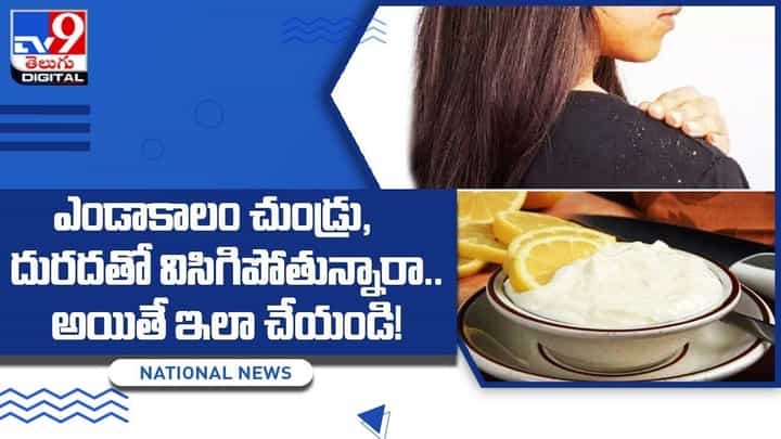 ఎండాకాలం చుండ్రు, దురదతో విసిగిపోతున్నారా ?? అయితే ఇలా చేయండి !! ఎండాకాలం చుండ్రు, దురదతో విసిగిపోతున్నారా ?? అయితే ఇలా చేయండి !!