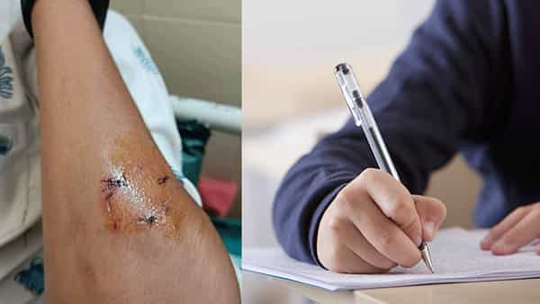 Copying: పరీక్షలో కాపీ కొడుతూ అడ్డంగా బుక్కైన విద్యార్థి.. కసితీరా కొరికిన లెక్చరర్.. ఎక్కడంటే..