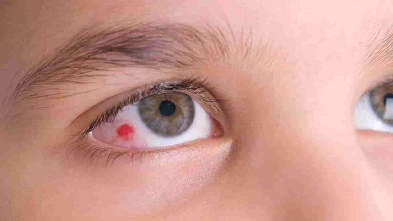 Eye Tips: వయసు పెరుగుతున్నకొద్ది కళ్లు దెబ్బతింటాయి.. ఈ నాలుగు జాగ్రత్తలు పాటిస్తే కళ్లు ఆరోగ్యవంతం