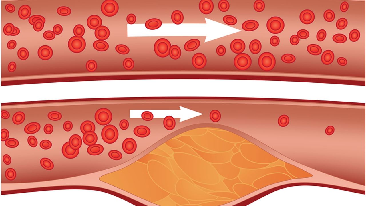 Health Tips: ఆహారంలో 3 రకాల కొవ్వులు ఉంటాయి.. అందులో ఏది మంచిదో ఏది చెడ్డదో తెలుసా..!