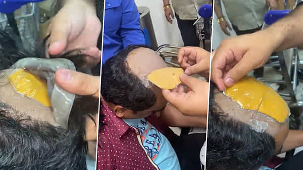 Gold Smuggling: వామ్మో.. వీడి తెలివి తగలెయ్యా! బట్టతలలో దాచి బంగారం స్మగ్లింగ్.. విగ్గు తీసి చూసిన అధికారులకు దిమ్మతిరిగే షాక్..
