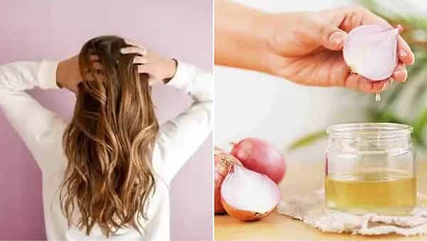 Hair Care Tips: జుట్టు సమస్యలతో సతమతం అవుతున్నారా? ఉల్లిపాయ నూనెతో ఇలా చేయండి..