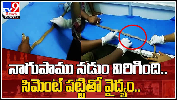 Cobra Video: నాగుపాము నడుం విరిగింది.. సిమెంట్ పట్టితో వైద్యం.. కానీ అసలు మేటర్ ఏంటంటే..? Cobra Video: నాగుపాము నడుం విరిగింది.. సిమెంట్ పట్టితో వైద్యం.. కానీ అసలు మేటర్ ఏంటంటే..?