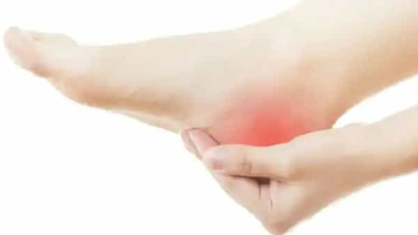 Health Care: మీకు మడమ నొప్పి బాధిస్తుందా..? ఉపశమనం కోసం ఈ చిట్కాలను అనుసరించండి