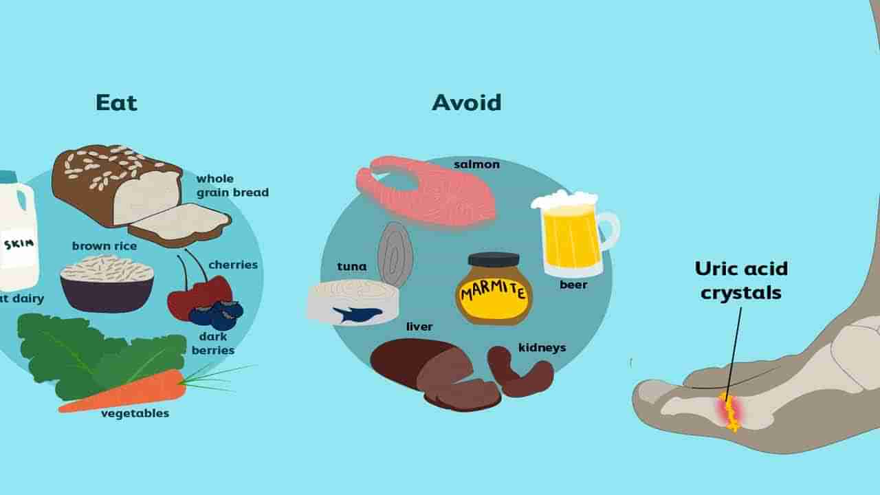 High Uric Acid: జాగ్రత్త.. ఈ పొరపాట్లు చేస్తే శరీరంలో యూరిక్ యాసిడ్ పెరుగుతుంది..   ఎంటంటే..