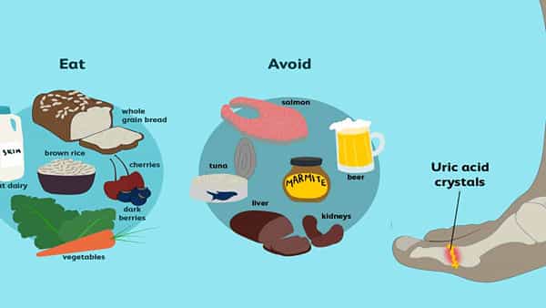 High Uric Acid: జాగ్రత్త.. ఈ పొరపాట్లు చేస్తే శరీరంలో యూరిక్ యాసిడ్ పెరుగుతుంది.. ఎంటంటే..