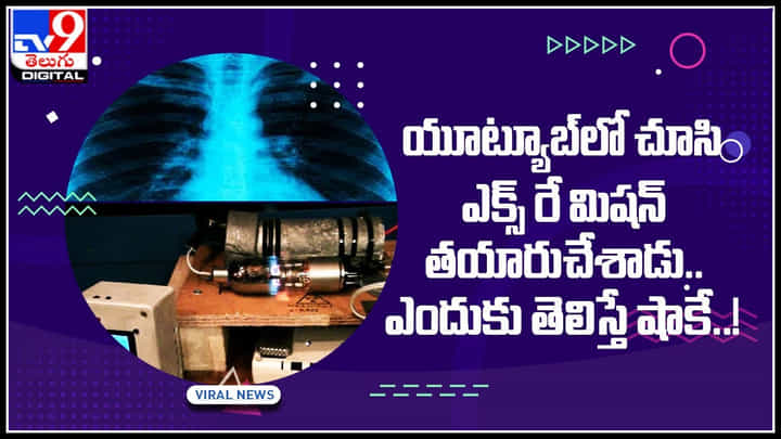 Xray mechion: యూట్యూబ్లో చూసి ఎక్స్ రే మిషన్ తయారుచేశాడు.. ఎందుకు తెలిస్తే షాకే..! Xray mechion: యూట్యూబ్లో చూసి ఎక్స్ రే మిషన్ తయారుచేశాడు.. ఎందుకు తెలిస్తే షాకే..!