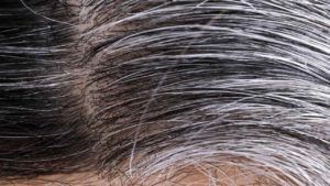 White Hair Problem: తెల్లజుట్టు రావడంతో పాటు వెట్రుకలు రాలిపోతున్నాయా.. అయితే ఈ పని చేయండి..