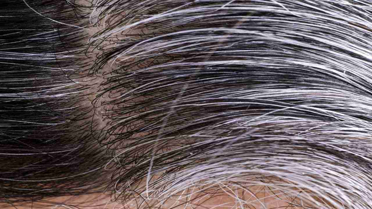 White Hair Problem: తెల్లజుట్టు రావడంతో పాటు వెట్రుకలు రాలిపోతున్నాయా.. అయితే ఈ పని చేయండి..