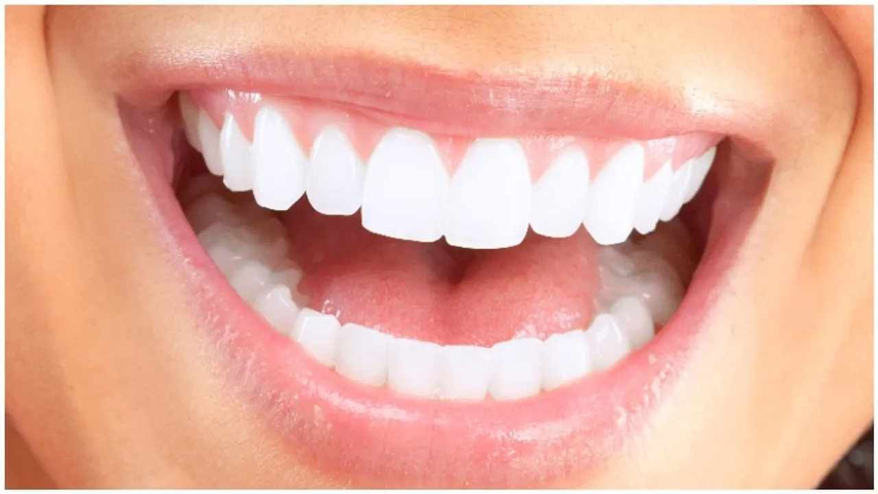 White Teeth
