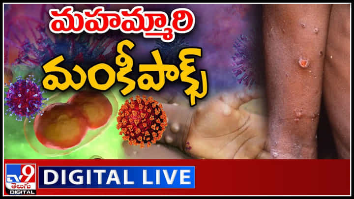 Monkey pox: మరింత ప్రమాదకరంగా మహమ్మారి మంకీపాక్స్.. లక్షణాలు ఇవే.. తస్మాత్ జాగ్రత్త..! Monkey pox: మరింత ప్రమాదకరంగా మహమ్మారి మంకీపాక్స్.. లక్షణాలు ఇవే.. తస్మాత్ జాగ్రత్త..!