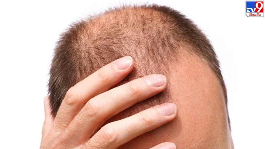 Bald Head