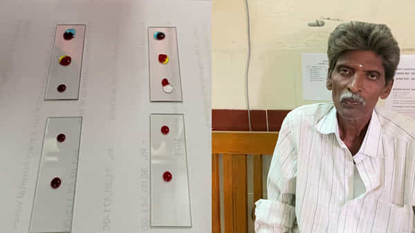 Bombay Blood Group: ప్రపంచంలో అత్యంత అరుదైన బ్లడ్ గ్రూప్, జనగామలో ఓ వ్యక్తికి అత్యవసరం..