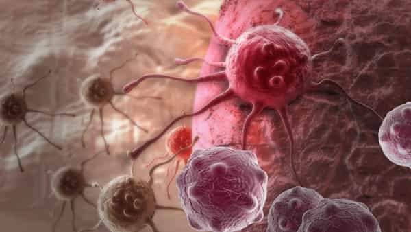 Cancers: ఈ 3 రకాల క్యాన్సర్లు చాలా ప్రమాదకరం.. ఈ లక్షణాలు కనిపిస్తే వెంటనే అప్రమత్తంకండి..!