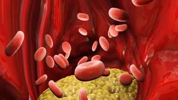 Health Tips: చెడు కొలెస్ట్రాల్ పెరుగుతోందని టెన్షన్ పడుతున్నారా.. ఈ పదార్థాలు తింటే.. త్వరగా కరిగిపోద్దంతే..