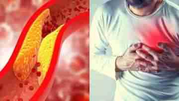 Cholesterol: కొలెస్ట్రాల్ పెరిగితే ప్రాణానికే ముప్పు.. రోజూ ఇలాంటి తప్పులు చేస్తుంటే ఇప్పుడే పుల్‌స్టాప్‌ పెట్టండి