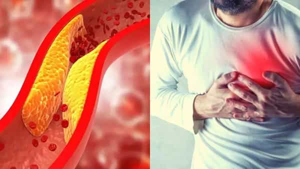Cholesterol: కొలెస్ట్రాల్ పెరిగితే ప్రాణానికే ముప్పు.. రోజూ ఇలాంటి తప్పులు చేస్తుంటే ఇప్పుడే పుల్స్టాప్ పెట్టండి