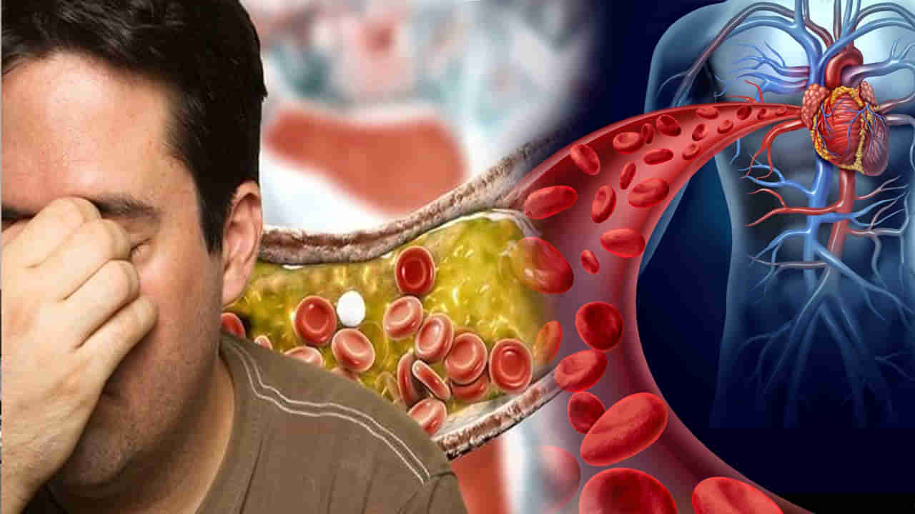 High Cholesterol: మీకు అధిక కొలెస్ట్రాల్‌ పెరిగిపోతోందా..? ఈ ప్రాణాంతక వ్యాధులకు దారి తీయవచ్చు.. జాగ్రత్త..!