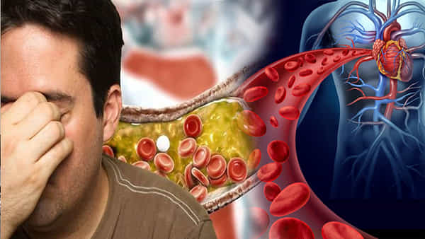 High Cholesterol: మీకు అధిక కొలెస్ట్రాల్ పెరిగిపోతోందా..? ఈ ప్రాణాంతక వ్యాధులకు దారి తీయవచ్చు.. జాగ్రత్త..!