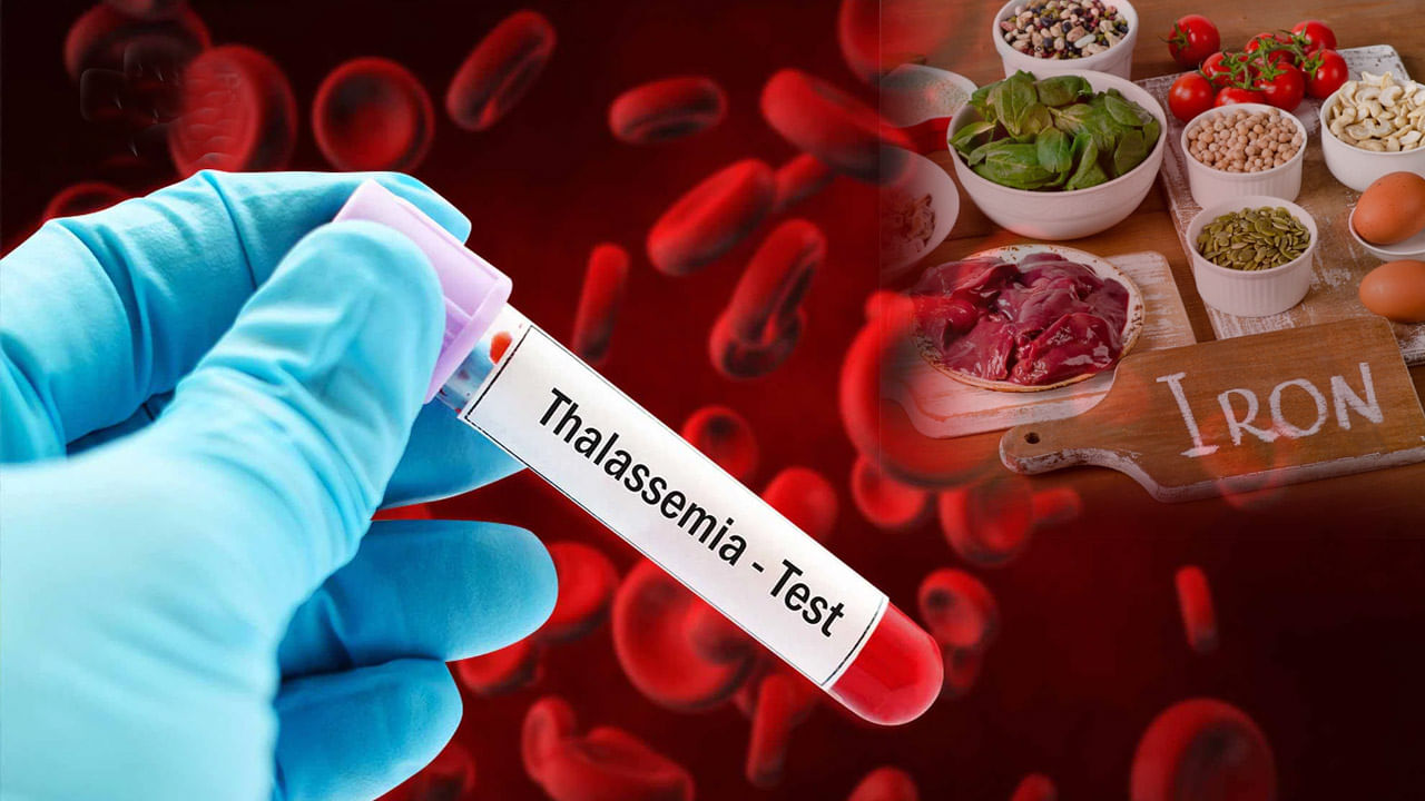 World Thalassemia Day 2022: తలసేమియా వ్యాధితో బాధపడుతున్నారా..?  ఎలాంటి జాగ్రత్తలు తీసుకోవాలి? ఏం తినాలి..? ఏం తినకూడదు