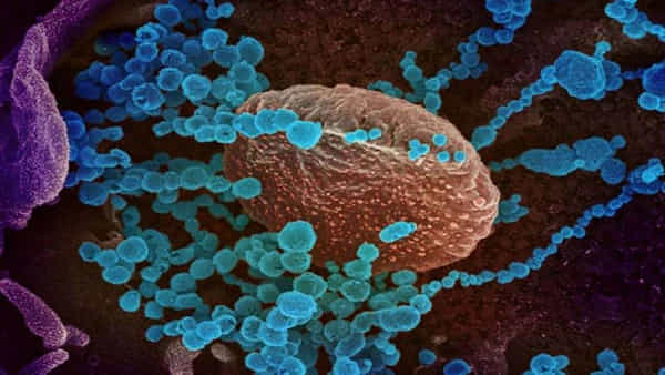 Disease X: డిసీజ్ ఎక్స్.. మాయదారి కొత్త రోగం.. సోకితే చావే..! ఇదో ఊహాజనితమైన అంటువ్యాధి