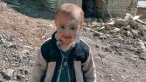 Afghanistan Earthquake: భూకంపంలో అందర్నీ కోల్పోయి ఒంటరైన చిన్నారి.. దత్తత తీసుకునేందుకు వందలాది మంది రెడీ