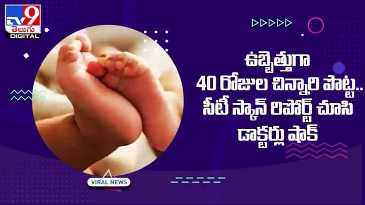 ఉబ్బెత్తుగా 40 రోజుల చిన్నారి పొట్ట !! సీటీ స్కాన్ రిపోర్ట్ చూసి డాక్టర్లు షాక్ !! ఉబ్బెత్తుగా 40 రోజుల చిన్నారి పొట్ట !! సీటీ స్కాన్ రిపోర్ట్ చూసి డాక్టర్లు షాక్ !!